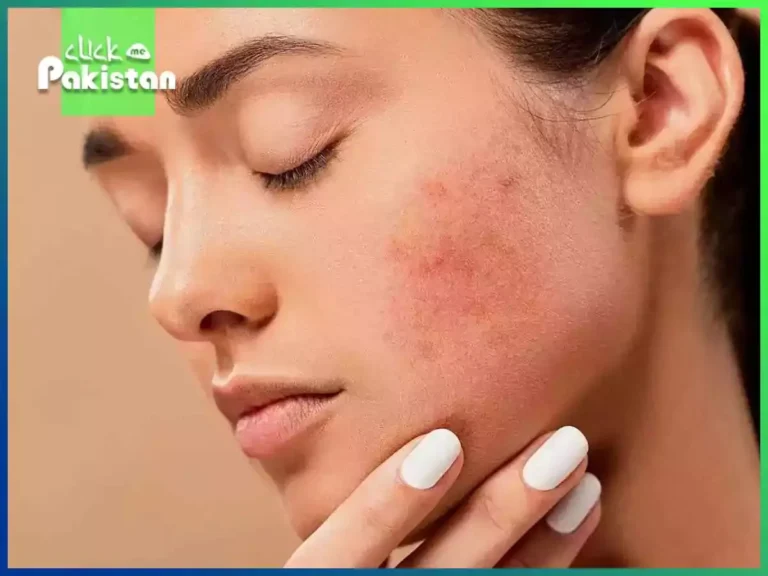 Beauty In Brief Quick Fixes For Damaged Skin