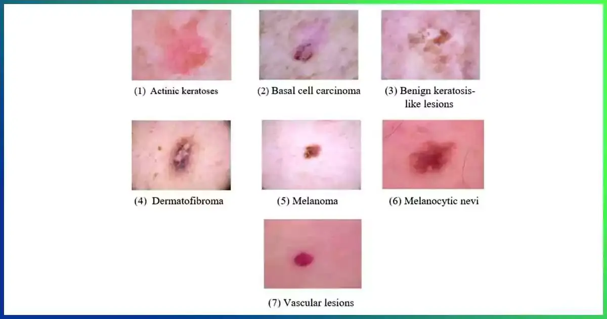 Identifying Damaged Skin